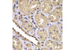 Immunohistochemistry of paraffin-embedded human kidney using BAG2 antibody at dilution of 1:100 (40x lens). (BAG2 anticorps)