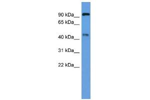 WB Suggested Anti-Ece2 Antibody Titration:  0. (ECE2 anticorps  (Middle Region))