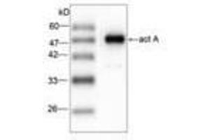 Image no. 1 for anti-Listeria Monocytogenes ActA (AA 117-278) antibody (ABIN791620) (Listeria Monocytogenes ActA (AA 117-278) anticorps)