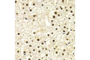 Immunohistochemistry of paraffin-embedded human liver injury using DDB1 Antibody. (DDB1 anticorps)