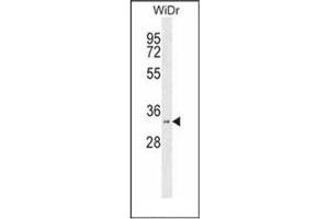 Western blot analysis of 17-beta-HSD11 / HSD17B11 Antibody (N-term) in WiDr cell line lysates (35ug/lane). (HSD17B11 anticorps  (N-Term))