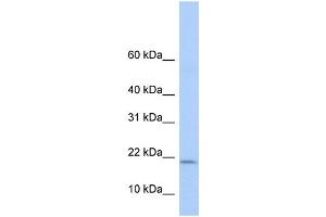 WB Suggested Anti-POLR1D Antibody Titration:  0. (POLR1D anticorps  (Middle Region))