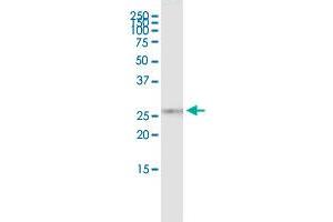 Immunoprecipitation of KIF26A transfected lysate using rabbit polyclonal anti-KIF26A and Protein A Magnetic Bead ( U0007 ), and immunoblotted with mouse purified polyclonal anti-KIF26A. (KIF26A (Humain) IP-WB Antibody Pair)