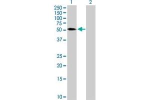 Western Blot analysis of TRIM65 expression in transfected 293T cell line by TRIM65 MaxPab polyclonal antibody. (TRIM65 anticorps  (AA 1-517))