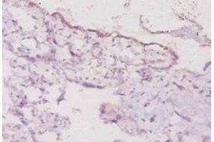 Immunohistochemistry of paraffin-embedded human placenta tissue using ABIN7177333 at dilution of 1:20 (Interferon gamma anticorps  (AA 27-155))