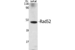 Western Blot analysis of various cells using Rad52 Polyclonal Antibody. (RAD52 anticorps)