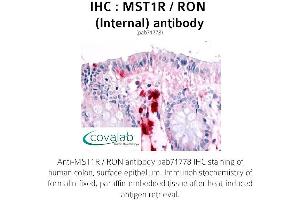 Image no. 1 for anti-Macrophage Stimulating 1 Receptor (C-Met-Related tyrosine Kinase) (MST1R) (Internal Region) antibody (ABIN1737097) (MST1R anticorps  (Internal Region))