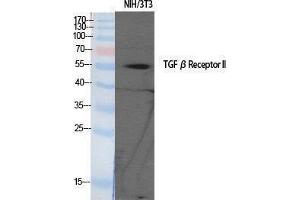 Western Blotting (WB) image for anti-Transforming Growth Factor, beta Receptor II (70/80kDa) (TGFBR2) (Tyr159) antibody (ABIN3177698) (TGFBR2 anticorps  (Tyr159))