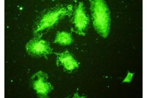 Detection of TLR5 in A549 cells using Polyclonal Antibody to Toll Like Receptor 5 (TLR5) (TLR5 anticorps  (AA 46-205))