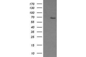 Image no. 2 for anti-Estrogen Receptor 1 (ESR1) antibody (ABIN1498061) (Estrogen Receptor alpha anticorps)