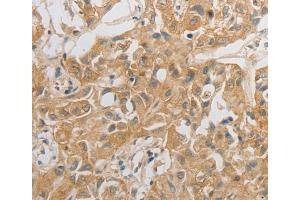 Immunohistochemistry (IHC) image for anti-Hypocretin (Orexin) Receptor 2 (HCRTR2) antibody (ABIN2431739) (HCRTR2 anticorps)