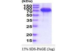 SDS-PAGE (SDS) image for Lymphocyte Cytosolic Protein 2 (SH2 Domain Containing Leukocyte Protein of 76kDa) (LCP2) (AA 1-533) protein (His tag) (ABIN7281315) (LCP2 Protein (AA 1-533) (His tag))