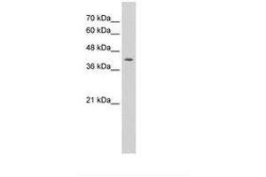 Image no. 1 for anti-Interferon Regulatory Factor 1 (IRF1) (N-Term) antibody (ABIN6736300) (IRF1 anticorps  (N-Term))