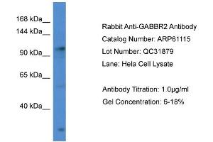 Western Blotting (WB) image for anti-gamma-aminobutyric Acid (GABA) B Receptor, 2 (GABBR2) (C-Term) antibody (ABIN2788680) (GABBR2 anticorps  (C-Term))