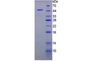 SDS-PAGE of Protein Standard from the Kit  (Highly purified E. (MUC1 Kit ELISA)