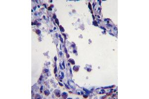 Immunohistochemistry (IHC) image for anti-Surfactant Protein C (SFTPC) antibody (ABIN2997467) (Surfactant Protein C anticorps)