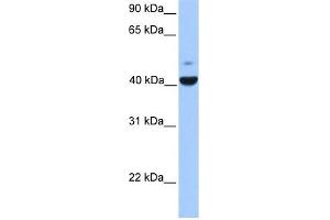 FGFR1OP antibody used at 1 ug/ml to detect target protein. (FGFR1OP anticorps  (N-Term))