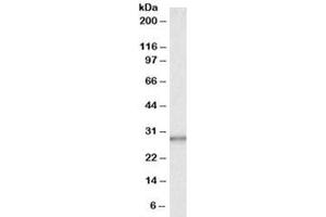 Western blot testing of human liver lysate with CA1 antibody at 0. (CA1 anticorps)