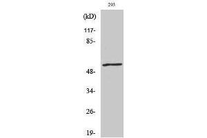 Western Blotting (WB) image for anti-Ephrin B1/B2 (Lys102), (Lys99) antibody (ABIN6282701) (Ephrin B1/B2 (Lys102), (Lys99) anticorps)