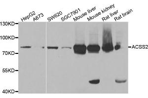 Western blot analysis of extracts of various cell lines, using ACSS2 antibody (ABIN5973869) at 1/1000 dilution. (ACSS2 anticorps)
