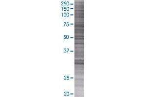 NAT9 transfected lysate. (NAT9 293T Cell Transient Overexpression Lysate(Denatured))