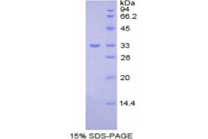 SDS-PAGE analysis of Human Ceruloplasmin Protein. (Ceruloplasmin Protéine)