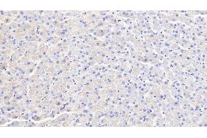 Detection of IFNg in Canine Liver Tissue using Polyclonal Antibody to Interferon Gamma (IFNg) (Interferon gamma anticorps  (AA 24-166))