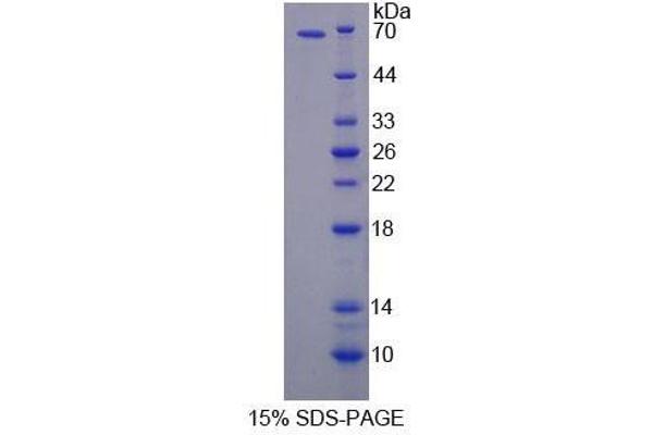 APBB2 Protein (AA 413-758) (GST tag,His tag)