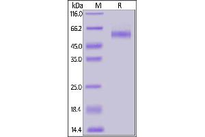 Biotinylated Human TGFBR2, Fc,Avitag on  under reducing (R) condition. (TGFBR2 Protein (AA 23-159) (Fc Tag,AVI tag,Biotin))