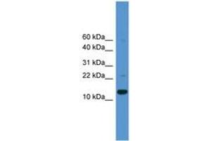 Image no. 1 for anti-Caspase 1 (CASP1) (AA 30-79) antibody (ABIN6745426) (Caspase 1 anticorps  (AA 30-79))