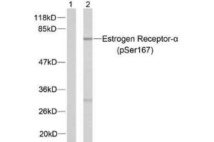 Western blot analysis of extracts from MCF7 cells using Estrogen Receptor-α (phospho-Ser167) antibody (E011073). (Estrogen Receptor alpha anticorps  (pSer167))