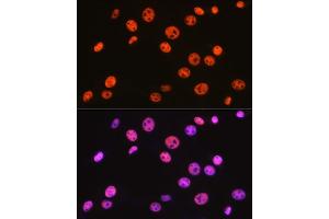 Immunofluorescence analysis of NIH-3T3 cells using B/SM Rabbit mAb (ABIN1679391, ABIN3018128, ABIN3018129 and ABIN7101578) at dilution of 1:100 (40x lens). (SMARCE1 anticorps)