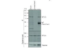 Immunoprecipitation analysis using Mouse Anti-VPS35 Monoclonal Antibody, Clone 5A9 (ABIN6932953). (VPS35 anticorps  (PerCP))