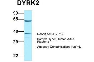 Host: Rabbit  Target Name: DYRK2  Sample Tissue: Human Adult Placenta  Antibody Dilution: 1. (DYRK2 anticorps  (C-Term))