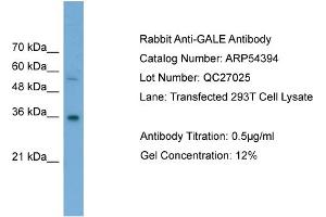 WB Suggested Anti-GALE  Antibody Titration: 0. (GALE anticorps  (Middle Region))