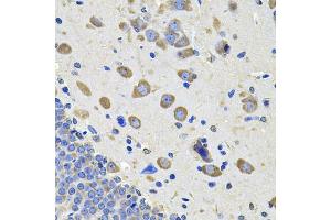 Immunohistochemistry of paraffin-embedded rat brain using GALNT2 Antibody (ABIN5974158) at dilution of 1/100 (40x lens). (GALNT2 anticorps)