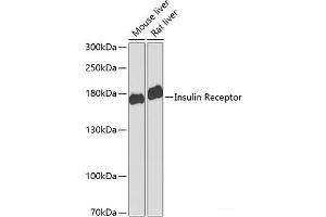 Western blot analysis of extracts of various cell lines using Insulin Receptor Polyclonal Antibody at dilution of 1:1000. (Insulin Receptor anticorps)