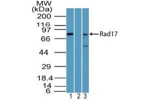 Image no. 1 for anti-RAD17 (RAD17) antibody (ABIN960319) (RAD17 anticorps)