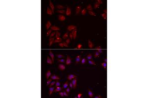 Immunofluorescence analysis of U2OS cells using PDXK antibody (ABIN5974032). (PDXK anticorps)