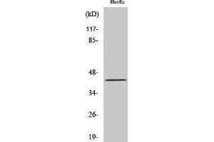 Western Blotting (WB) image for anti-Ret Finger Protein-Like 4A (RFPL4A) (Internal Region) antibody (ABIN3186740) (RFPL4A anticorps  (Internal Region))