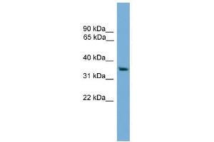 RAD51L1 antibody used at 0. (RAD51 Homolog B anticorps  (Middle Region))