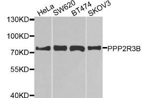 Western blot analysis of extracts of various cell lines, using PPP2R3B antibody (ABIN5974610) at 1/1000 dilution. (PPP2R3B anticorps)