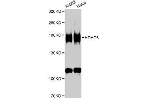 Western blot analysis of extracts of various cell lines, using HDAC6 antibody (ABIN5970867) at 1/1000 dilution. (HDAC6 anticorps)