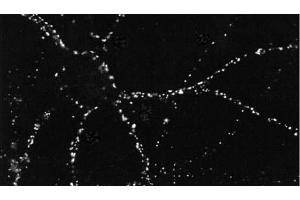 ICC of PSD95 in cultures of dissociated hippocampal neurons. (DLG4 anticorps  (PE))