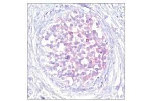 Image no. 1 for anti-V-Raf-1 Murine Leukemia Viral Oncogene Homolog 1 (RAF1) (pSer259) antibody (ABIN196619) (RAF1 anticorps  (pSer259))