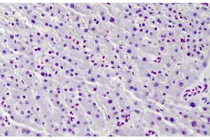 Immunohistochemistry (Formalin-fixed Paraffin-embedded Sections) (IHC (fp)) image for anti-Histone H4 (acLys12) antibody (ABIN604836)