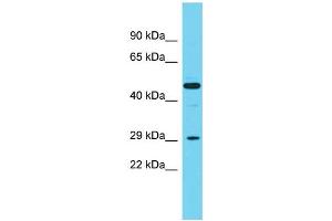 Host:  Rabbit  Target Name:  Cpa2  Sample Type:  Rat Spleen lysates  Antibody Dilution:  1. (Carboxypeptidase A2 anticorps  (Middle Region))