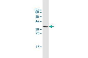 Western Blot detection against Immunogen (38. (TLR5 anticorps  (AA 517-634))