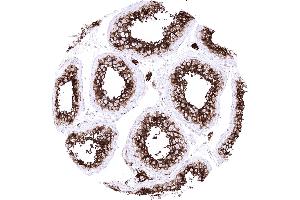 Testis Leydig cells and spermatocytes of the testis show a particularly strong ACE2 immunostaining in the testis (Recombinant ACE2 anticorps  (AA 705-805))