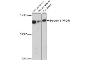 Western blot analysis of extracts of various cell lines, using Exportin 5 (XPO5) (XPO5) Rabbit mAb (ABIN1682763, ABIN3018126, ABIN3018127 and ABIN7101577) at 1:1000 dilution. (XPO5 anticorps)